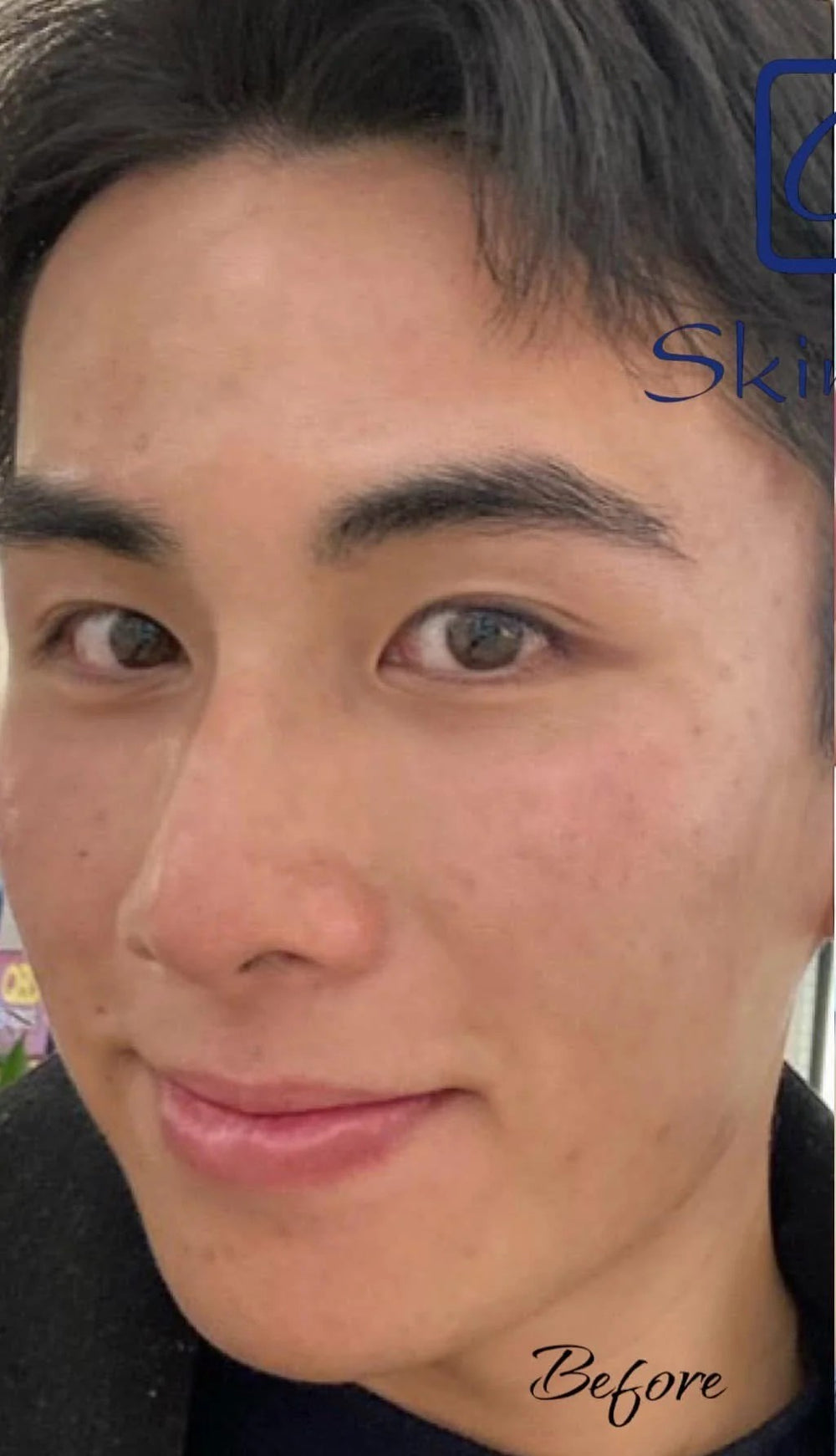 After