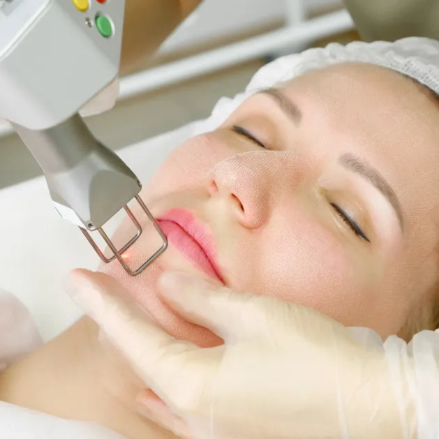 Laser hair Removal - Lips or Chin