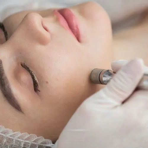 Diamond Microdermabrasion