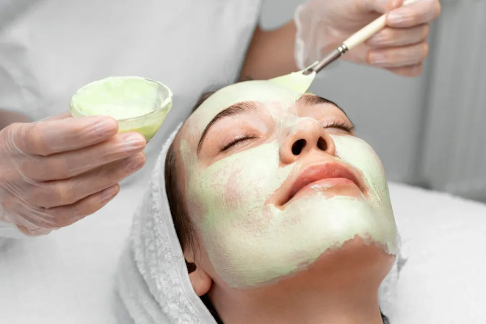 Acne Skin Peel
