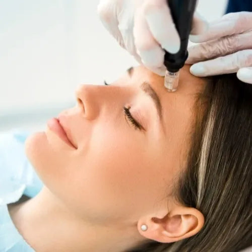 Skin Needling with stem cell serum